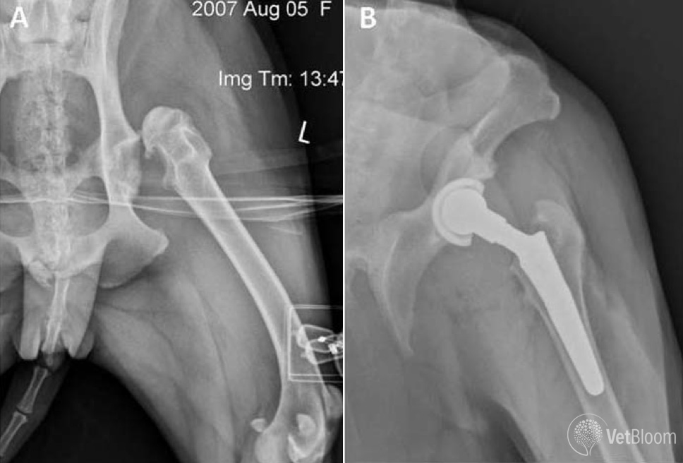 Indications and candidate screening for total hip replacement in the