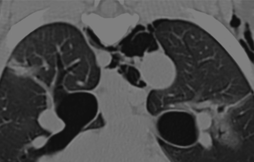 Thoracic CT: More than just a pretty picture